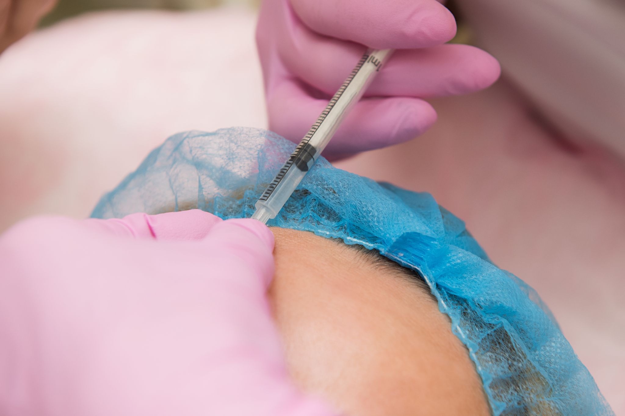 Close-up of injectable therapy for reducing skin scarring
