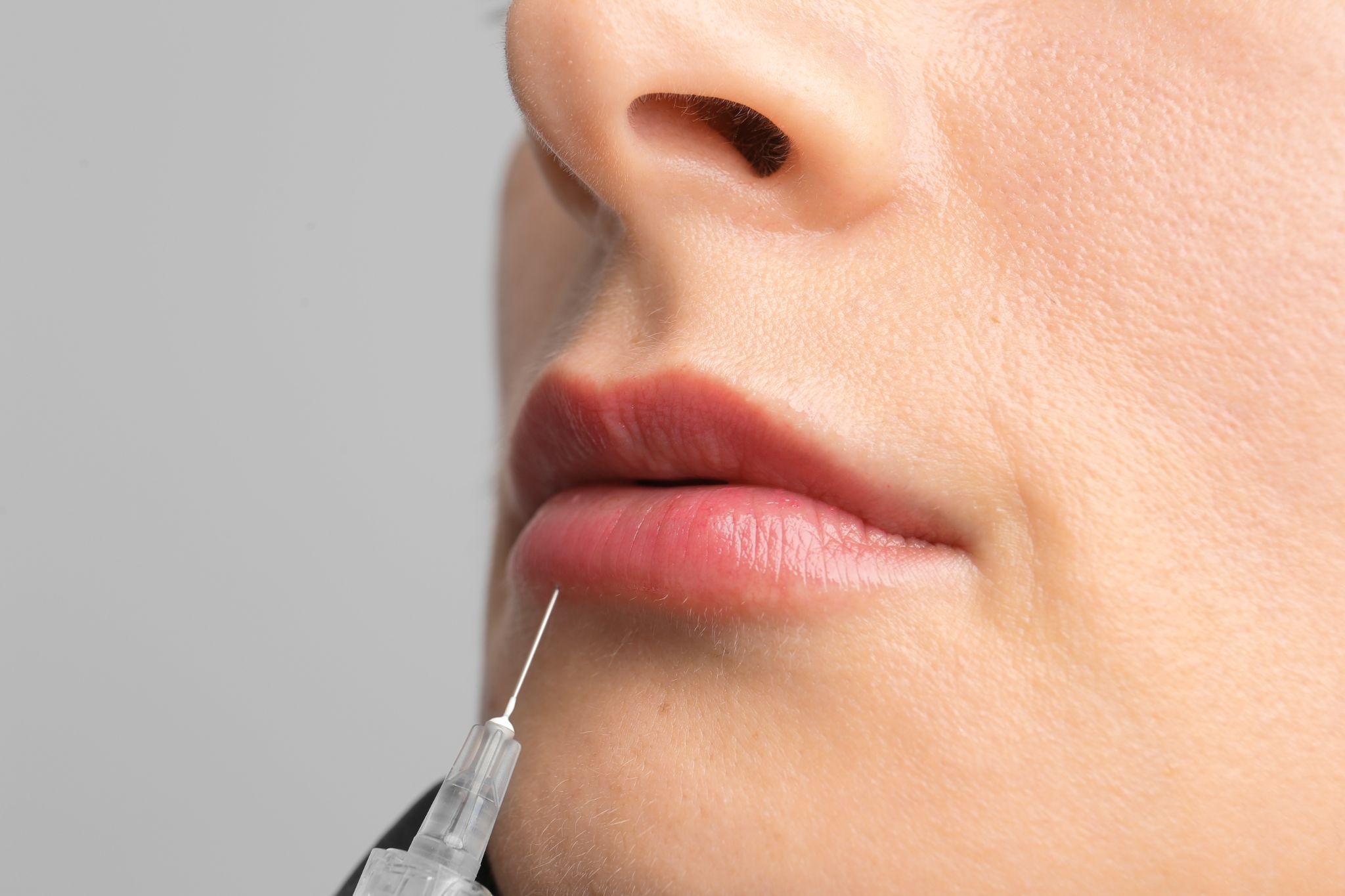 Detailed view of a dermal filler injection under the lower lip to enhance lip fullness and shape