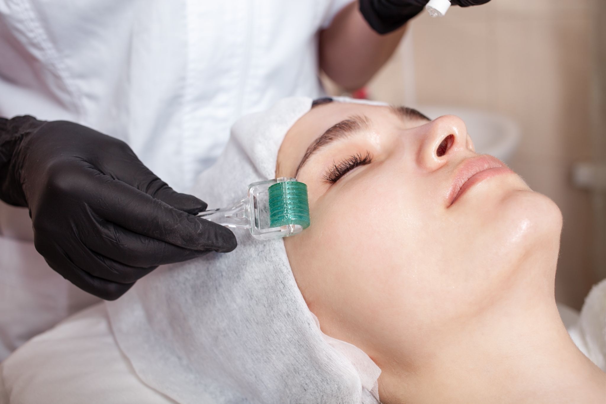 Woman receiving microneedling facial using a dermaroller for smoother, rejuvenated skin