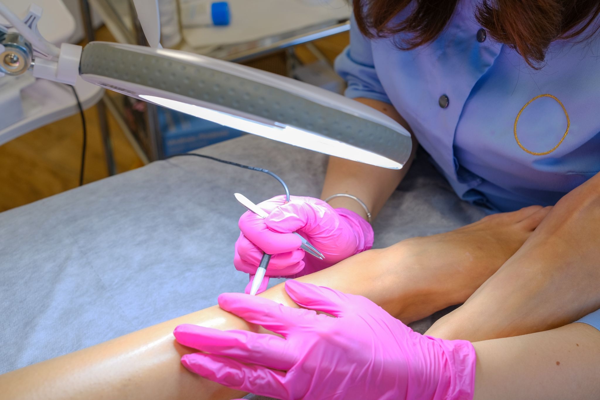 Close-up of electrolysis leg hair removal under magnifying light