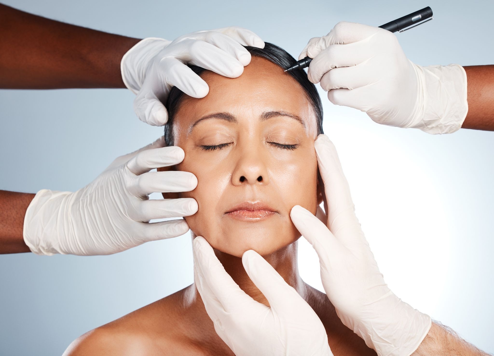 Gloved hands holding a woman’s face as a surgeon draws markings on her forehead before a facelift