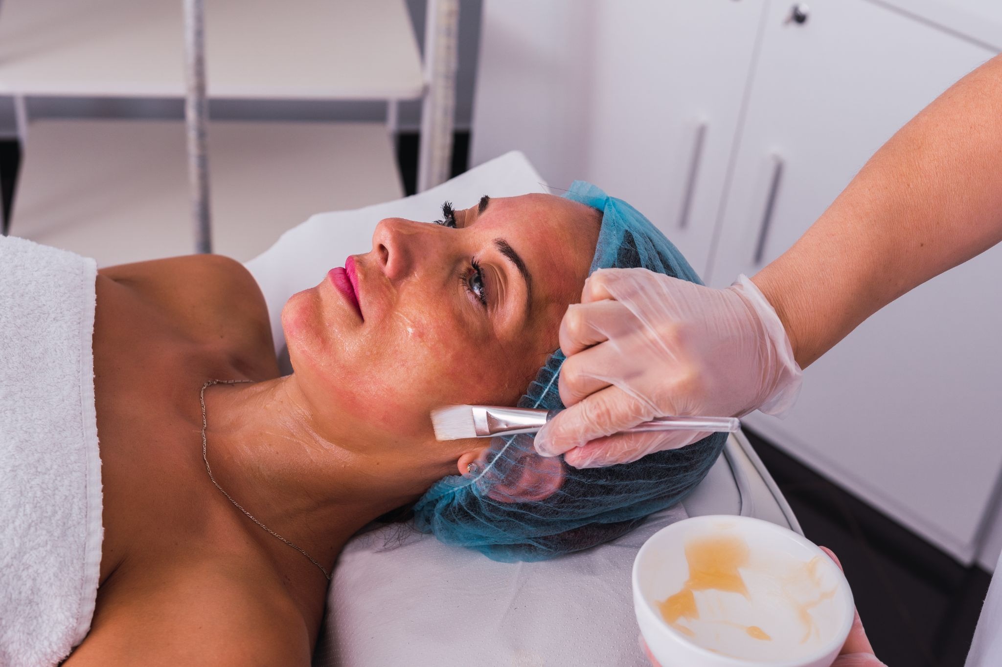 Esthetician applying chemical peel on a woman’s face for smoother, clearer skin