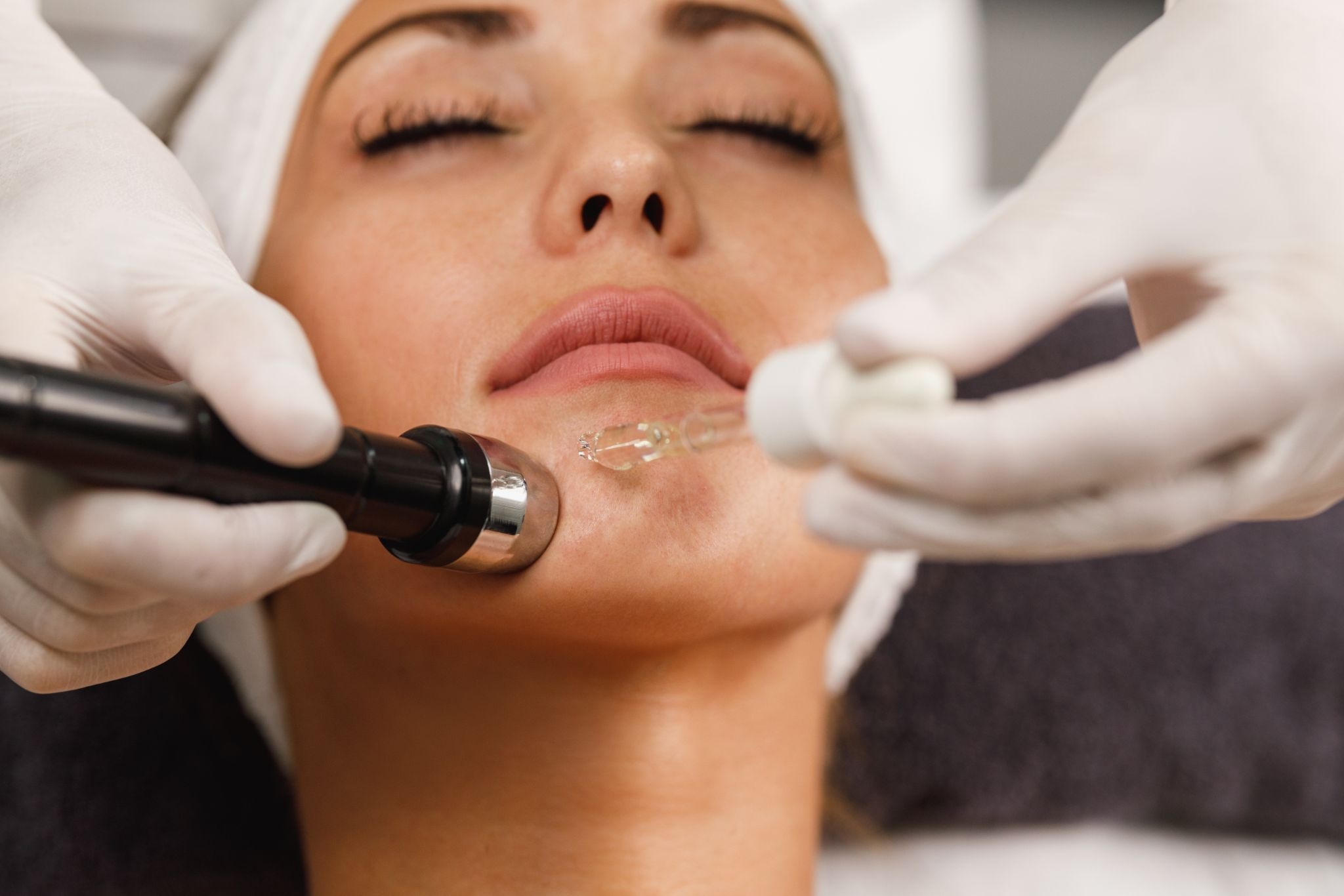 Woman receiving microchanneling facial with serum for enhanced absorption and skin rejuvenation