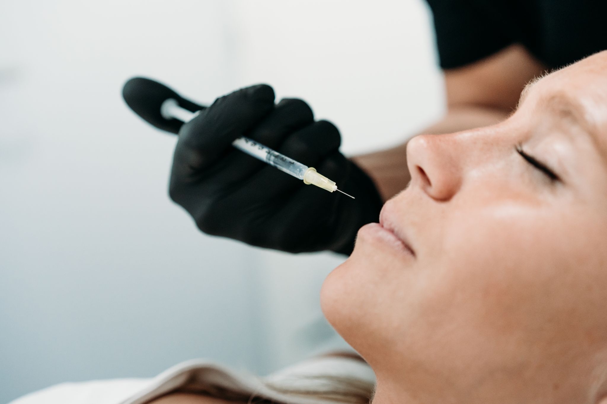 Side view of a woman receiving lip filler treatment