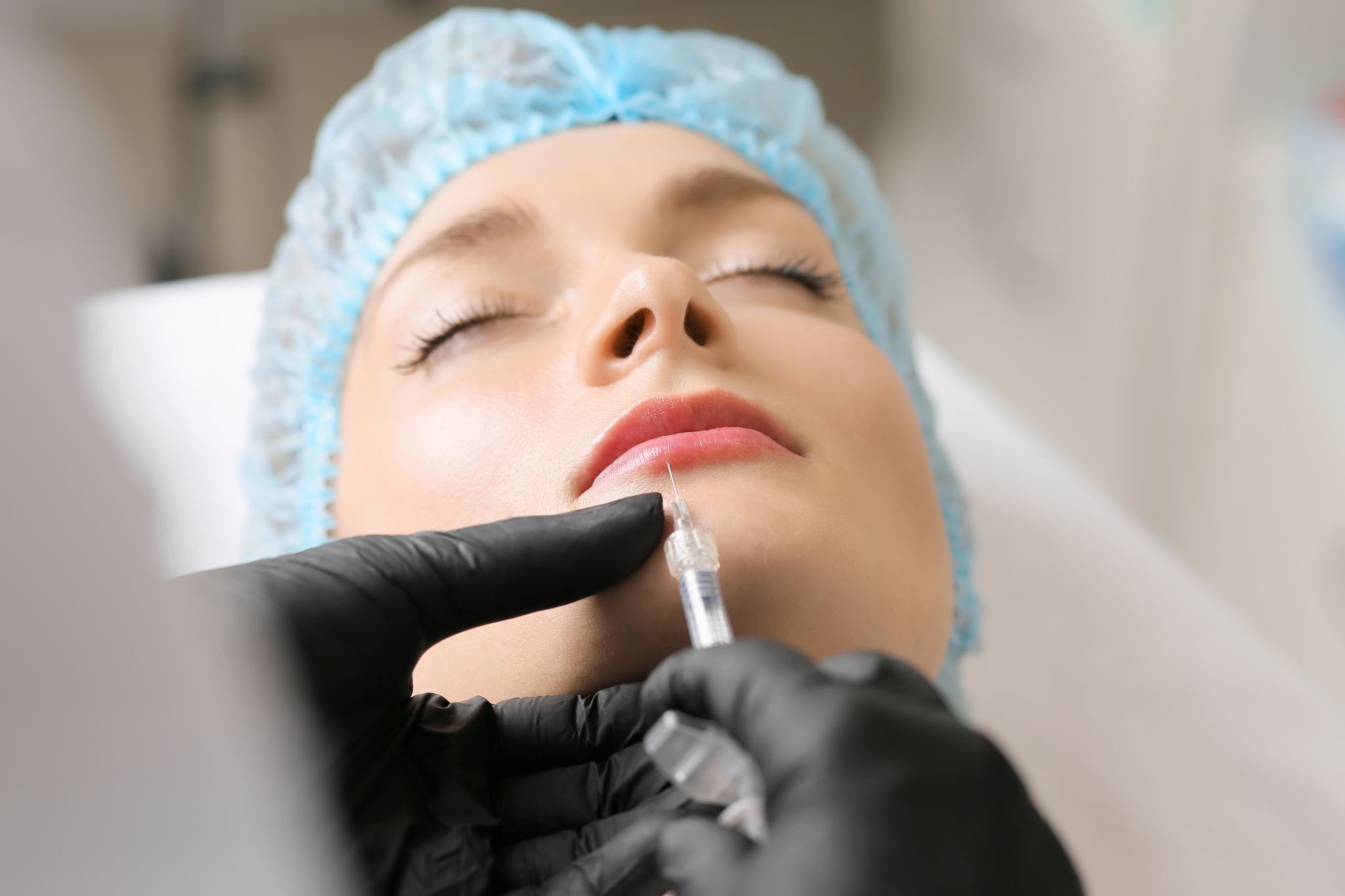 patient receiving injectable fillers for lip augmentation