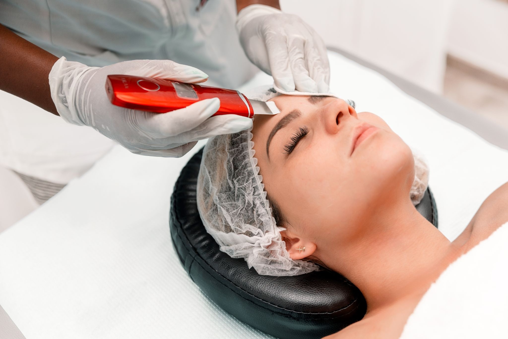 Patient undergoing dermaplaning to exfoliate the skin and remove peach fuzz