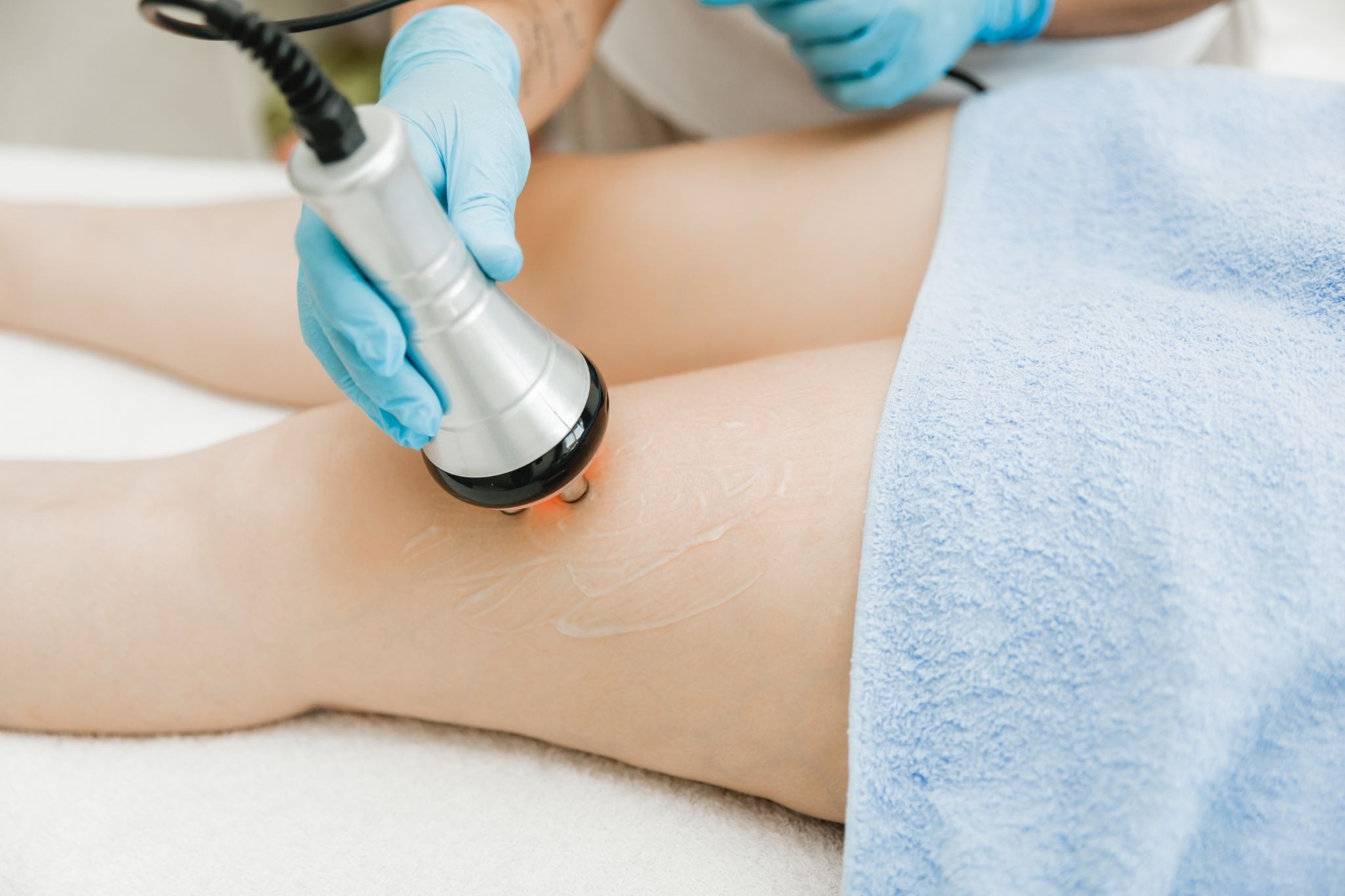 Woman receiving radiofrequency skin tightening treatment on her legs to improve skin firmness