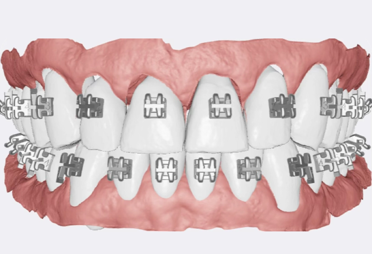 image of detailed cake selections