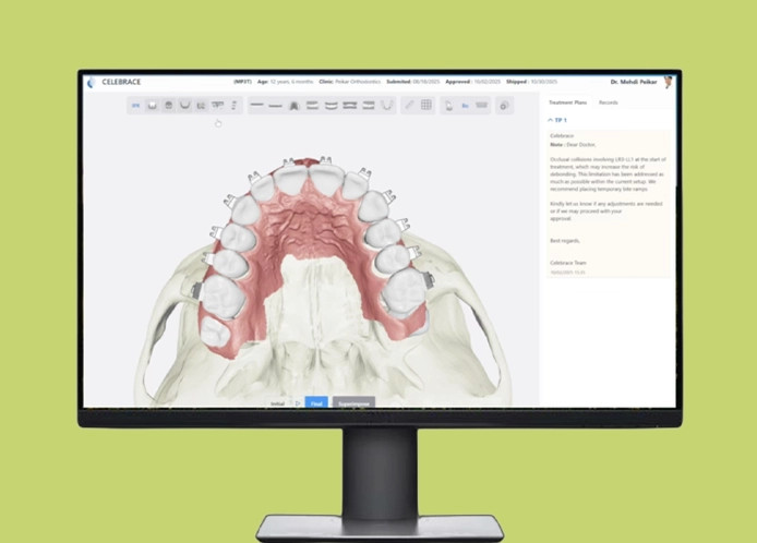 image of customized dental plans