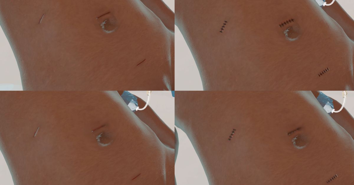 Incisions and dressings in VR