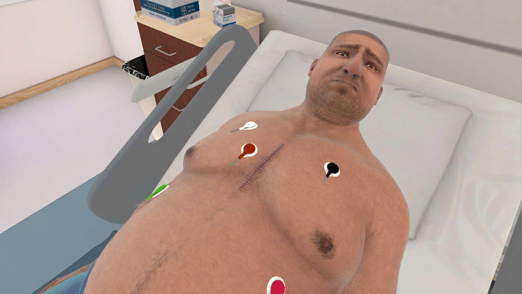 Post-op Coronary Artery Bypass Graft (CABG)