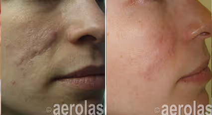 Before and after image:  surgical scar
