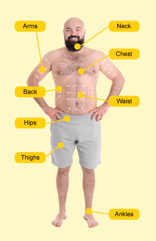 Emerald Laser treatment area diagram
