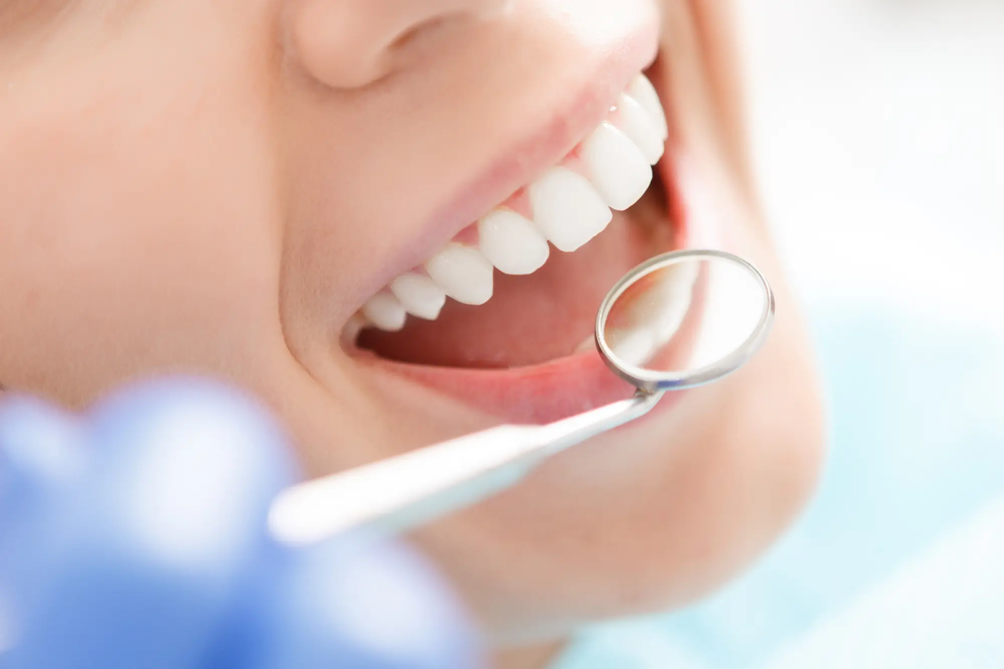 Teeth Bonding 101: The Ultimate Guide to a Brighter Smile