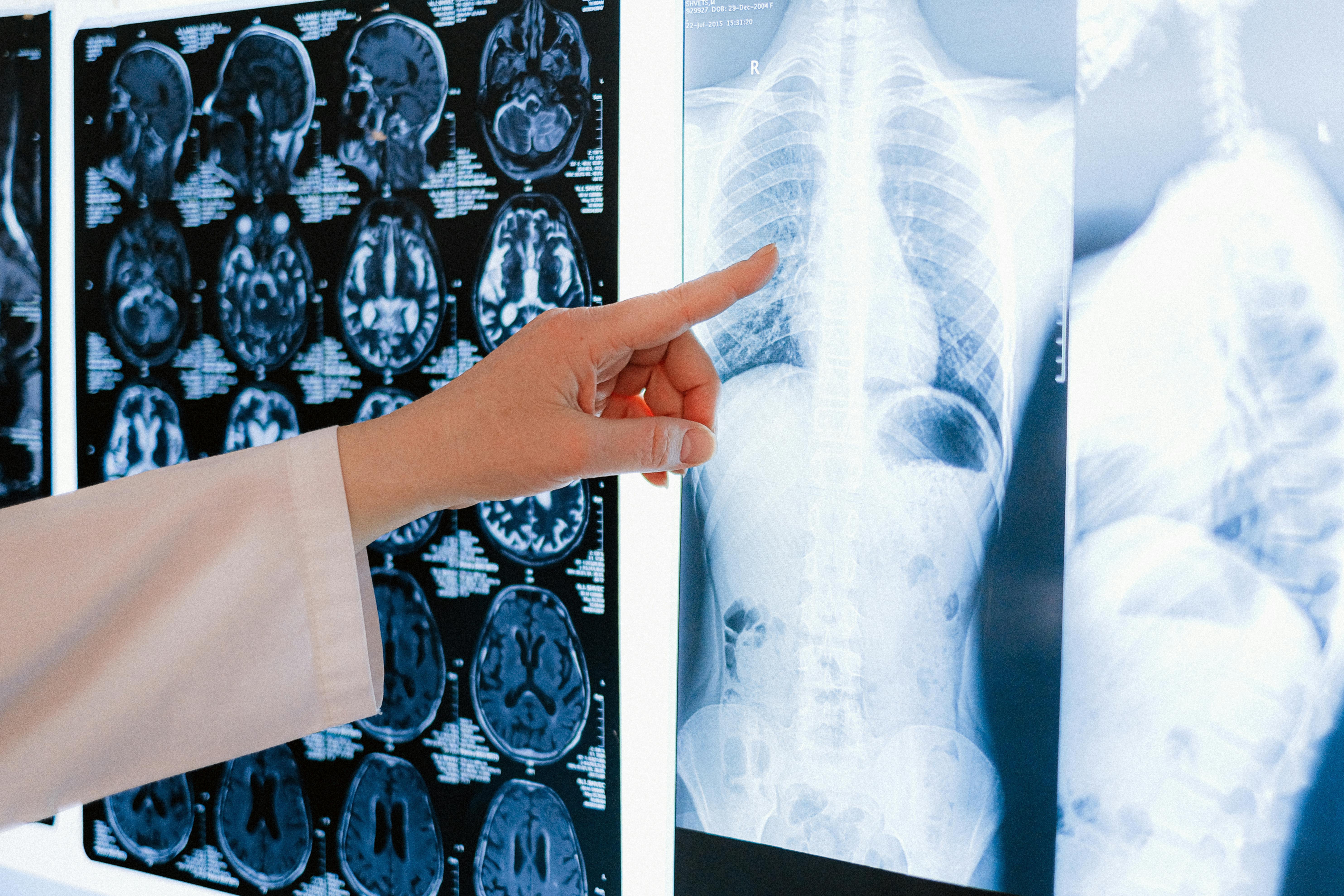 CMS Proposes New 2026 Updates for Remote Contrast