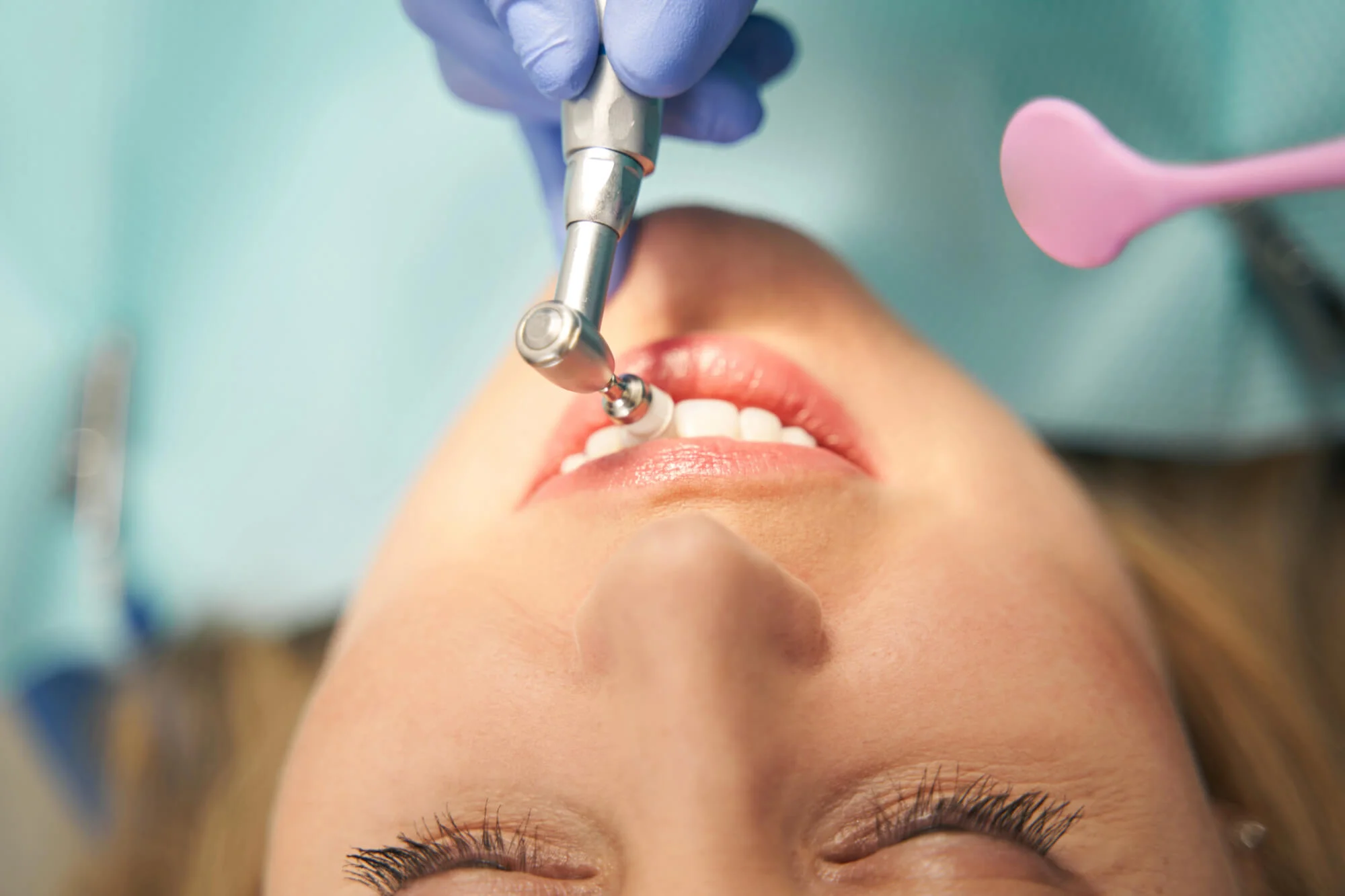 Patient receiving professional teeth polishing, dental cleaning Spring Hill, TN