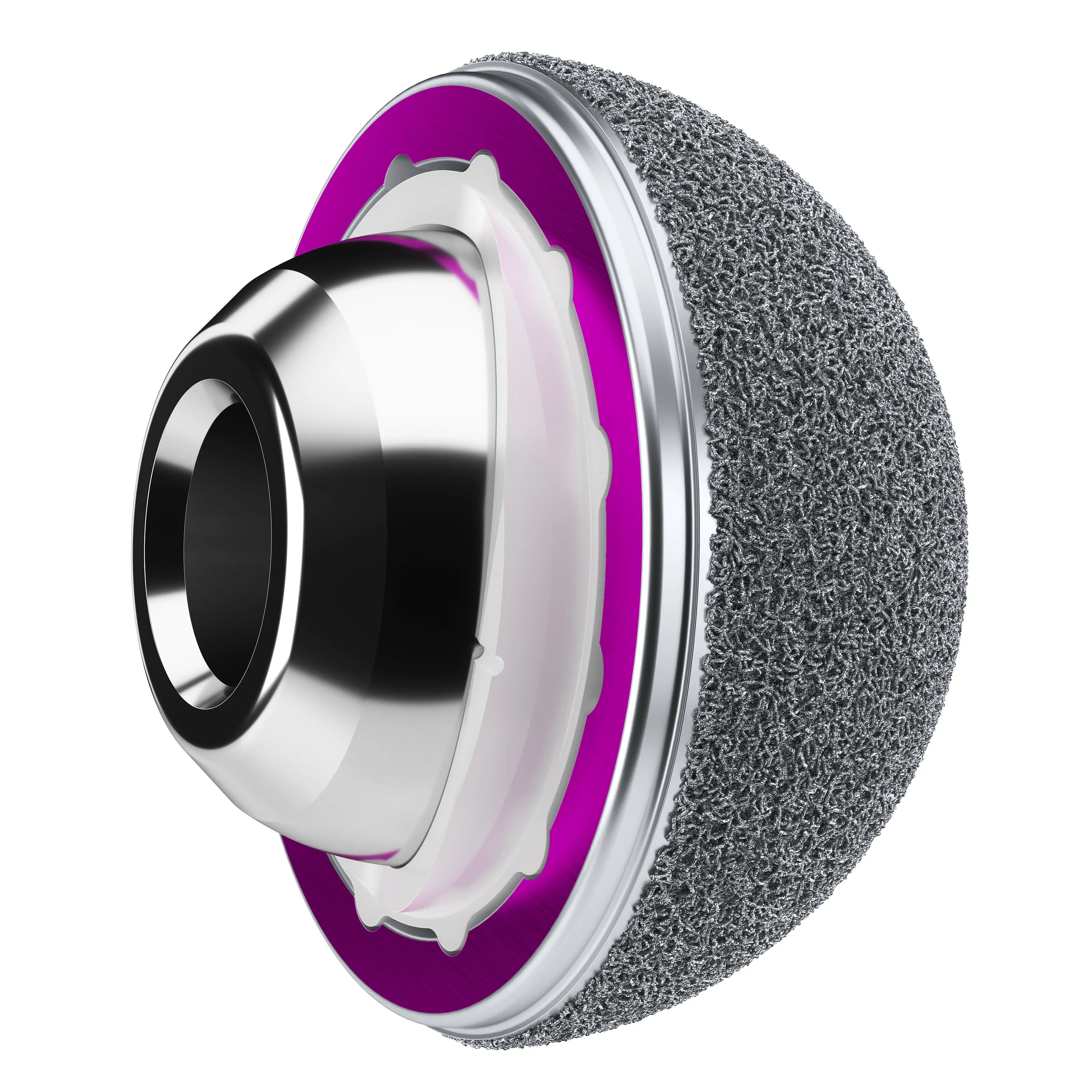 High-resolution 3D render of hip implant with textured shell, bright rim liner, and polished head