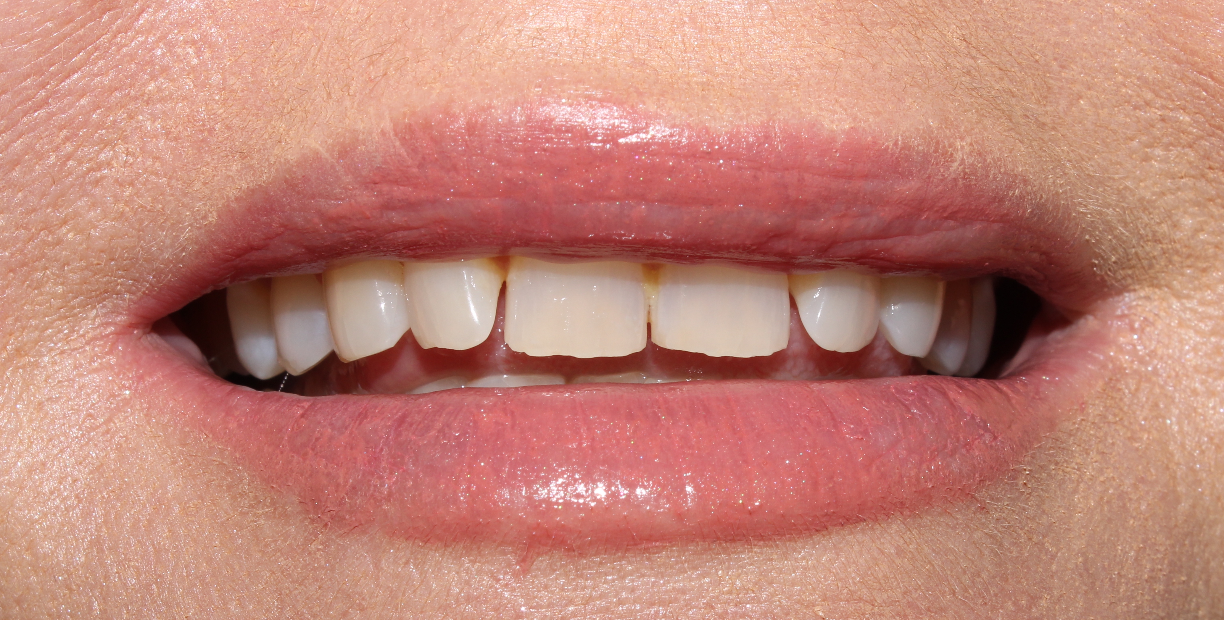 Case 01 before treatment