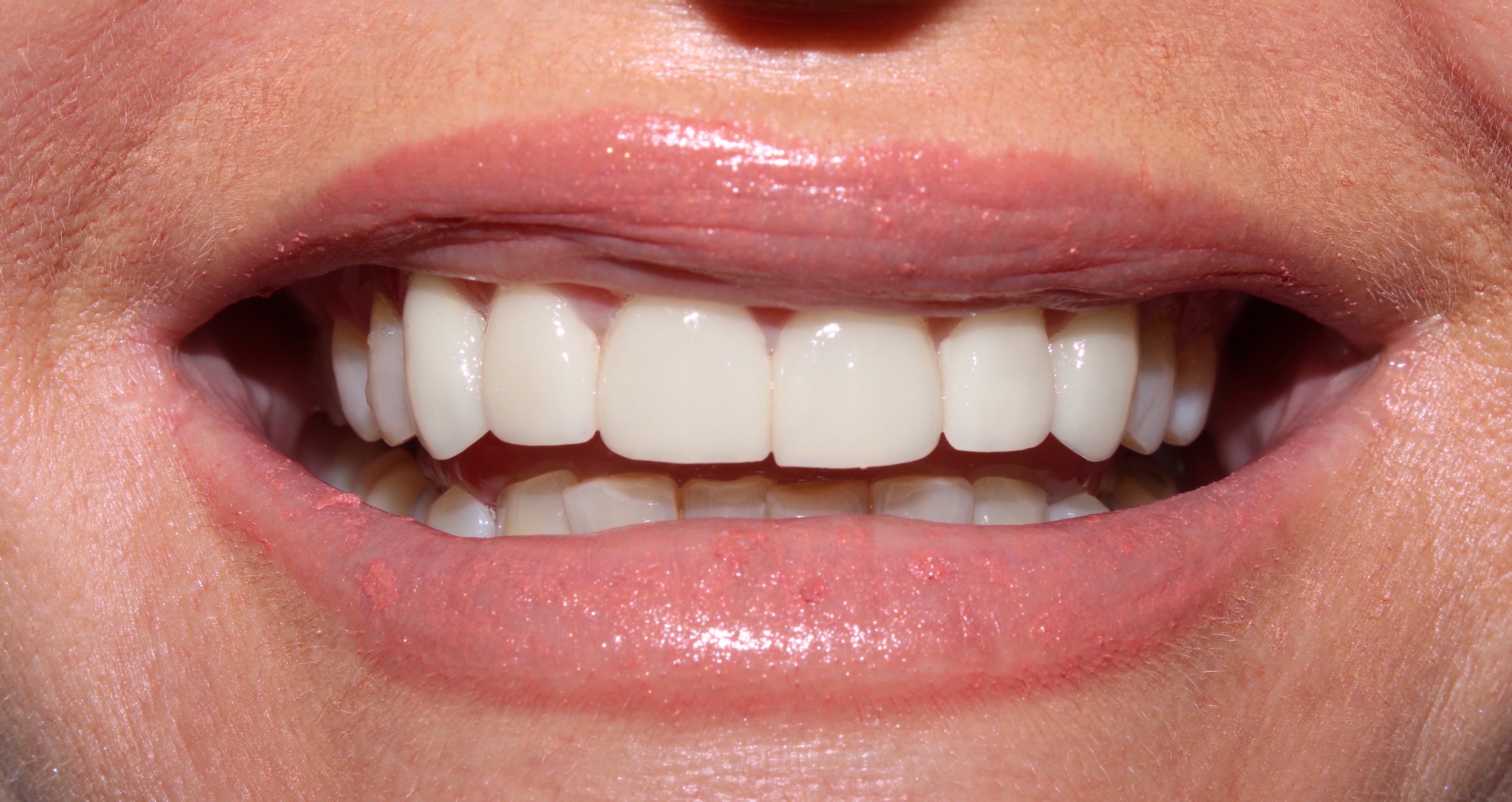 Case 01 after treatment