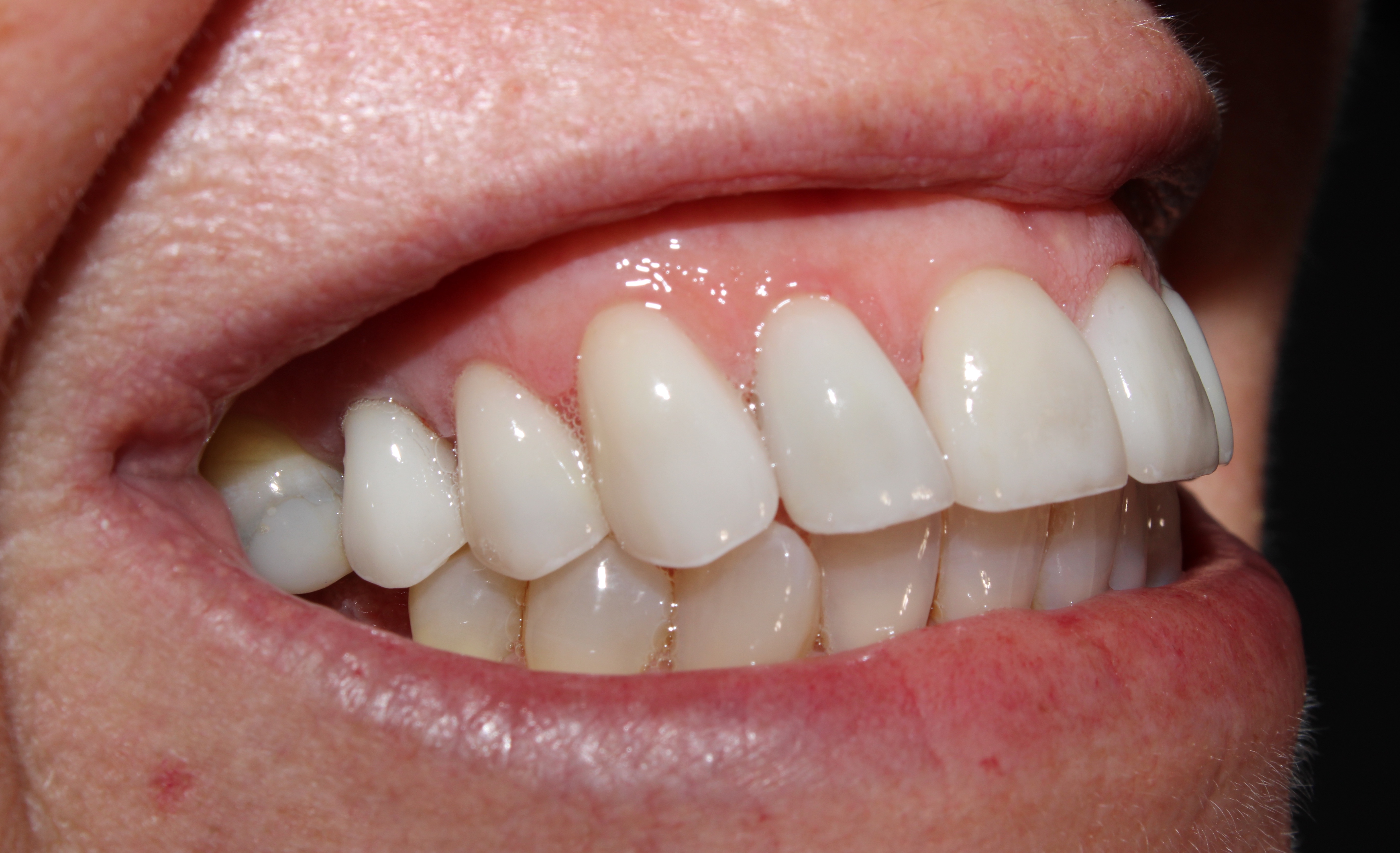 Case 02 after treatment