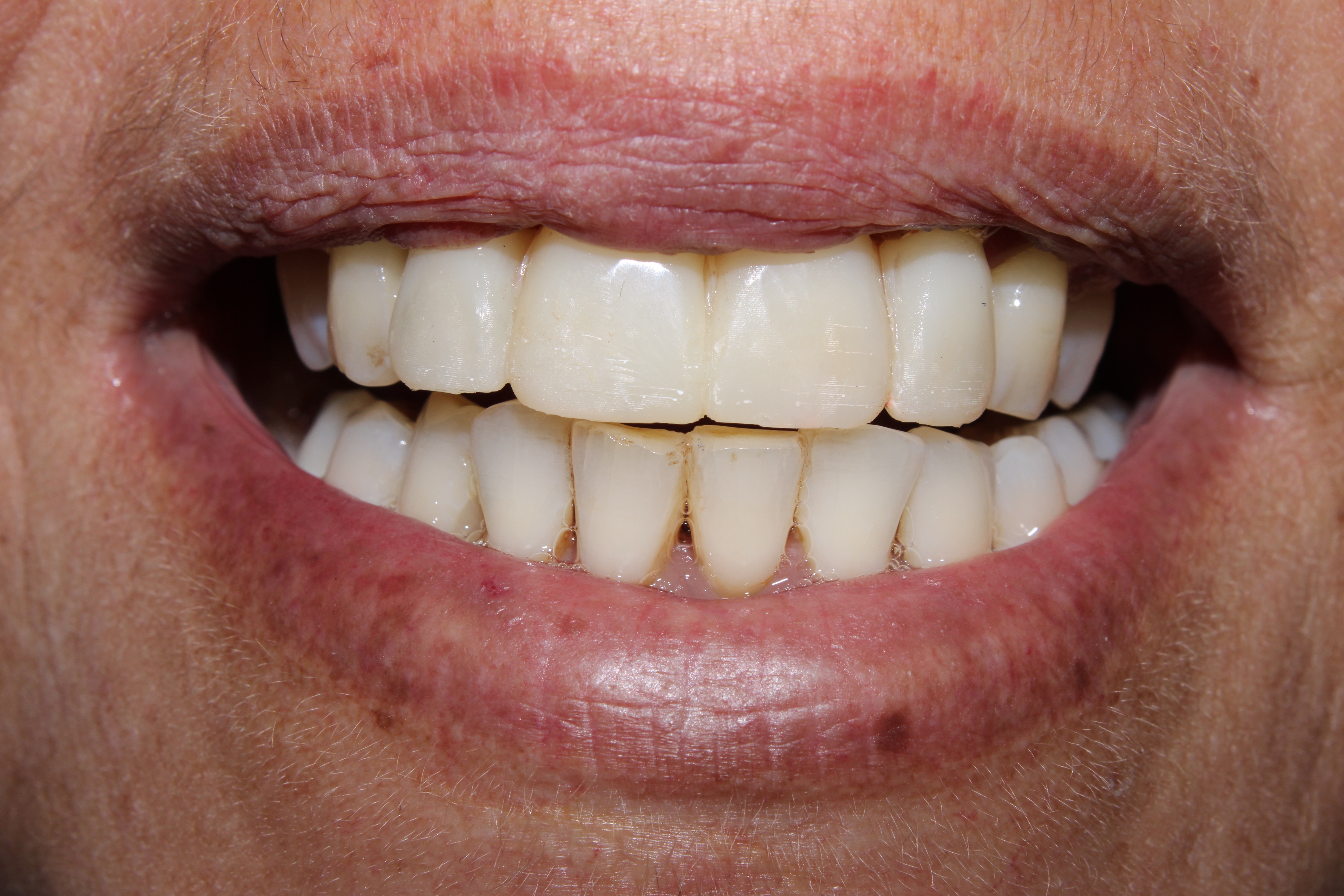 Case 03 after treatment