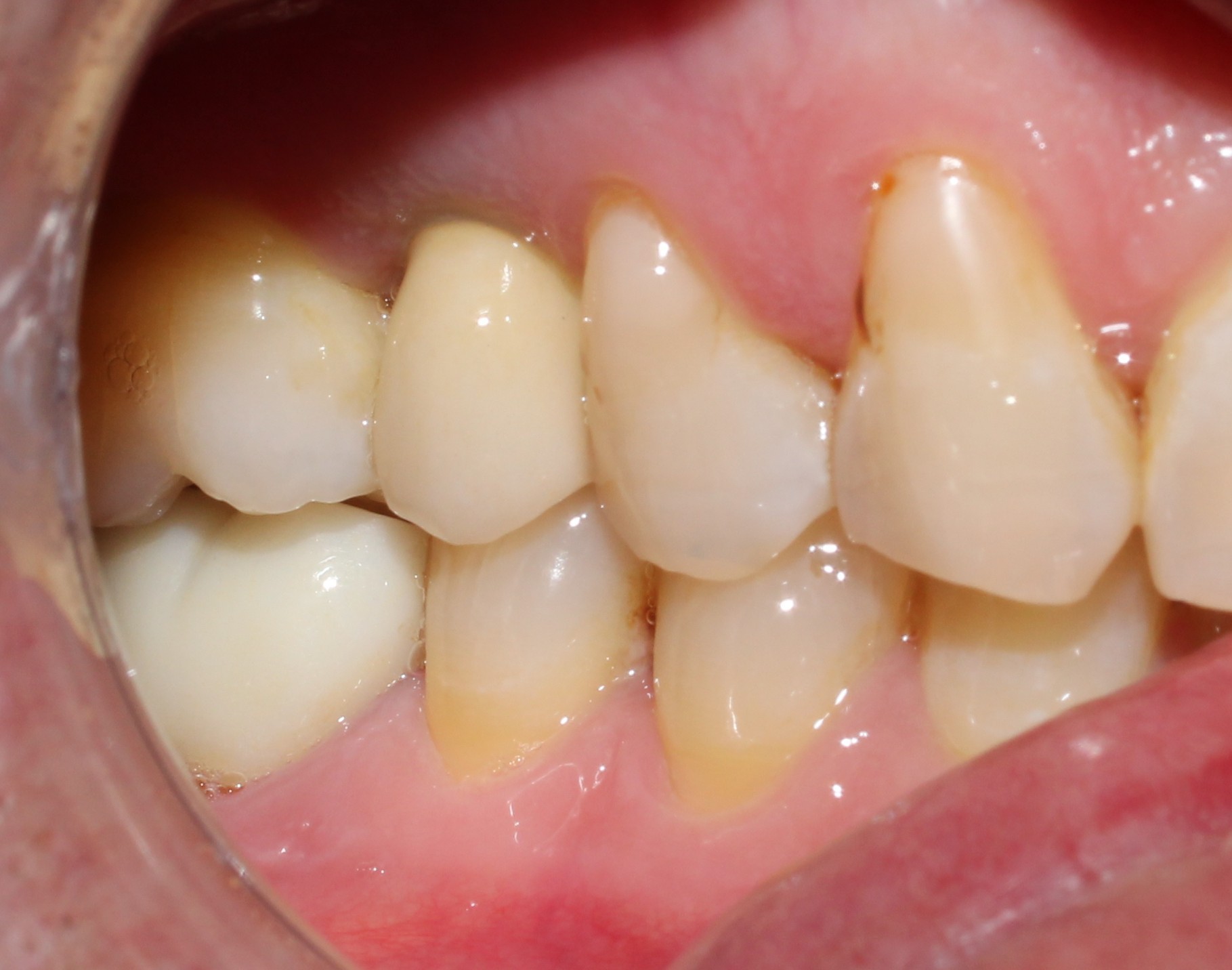 Case 01 after treatment