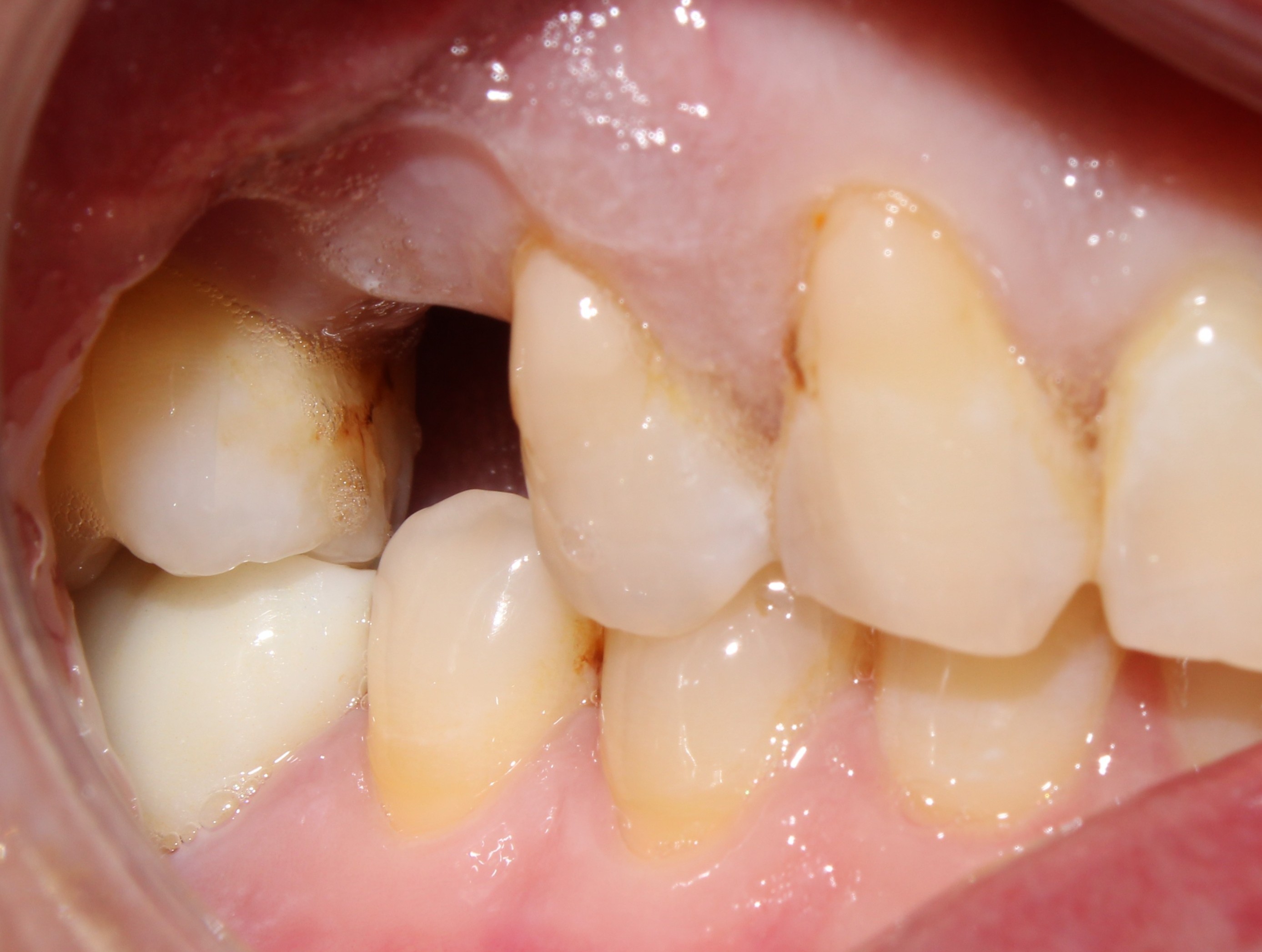 Case 01 before treatment