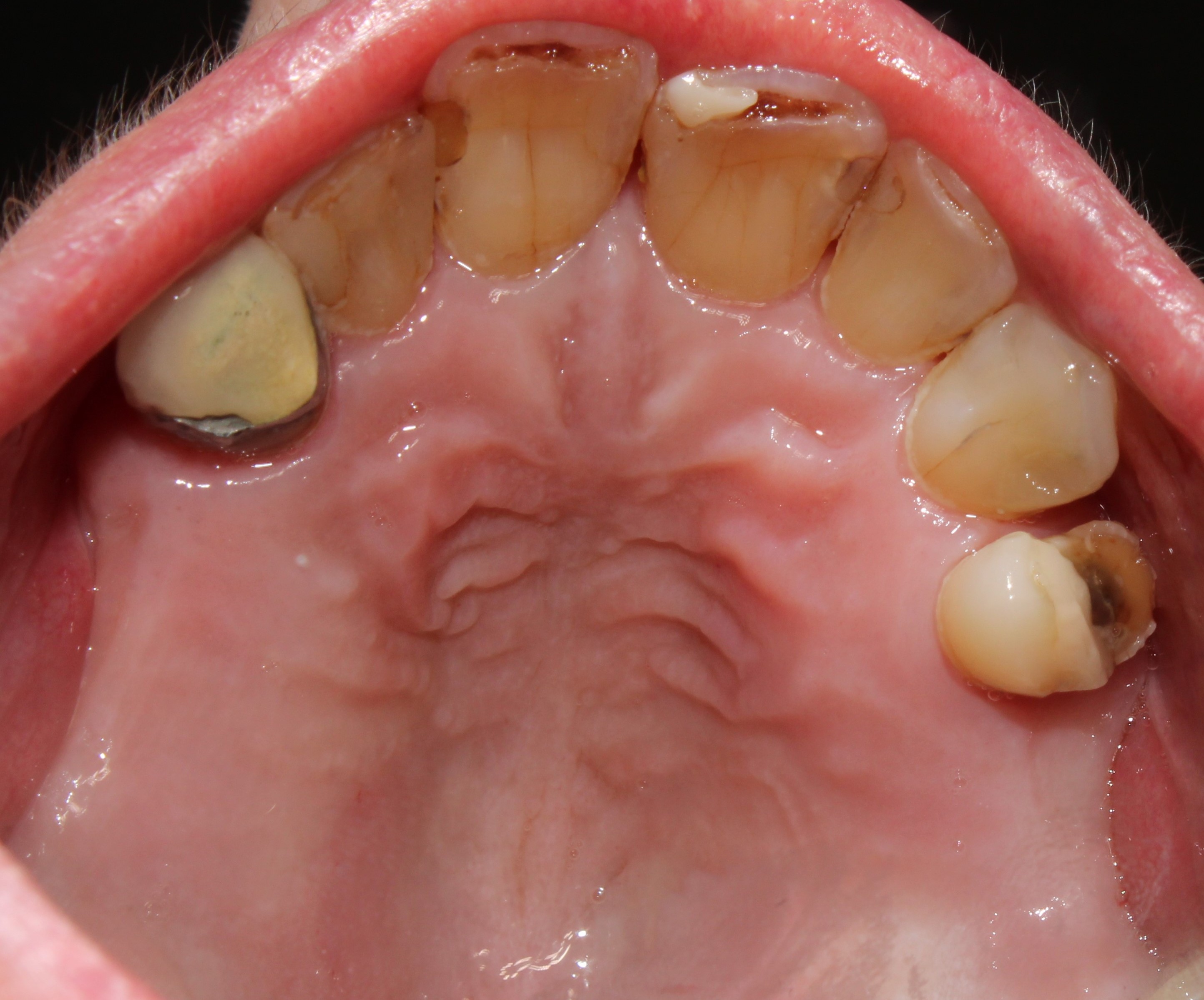 Case 02 before treatment