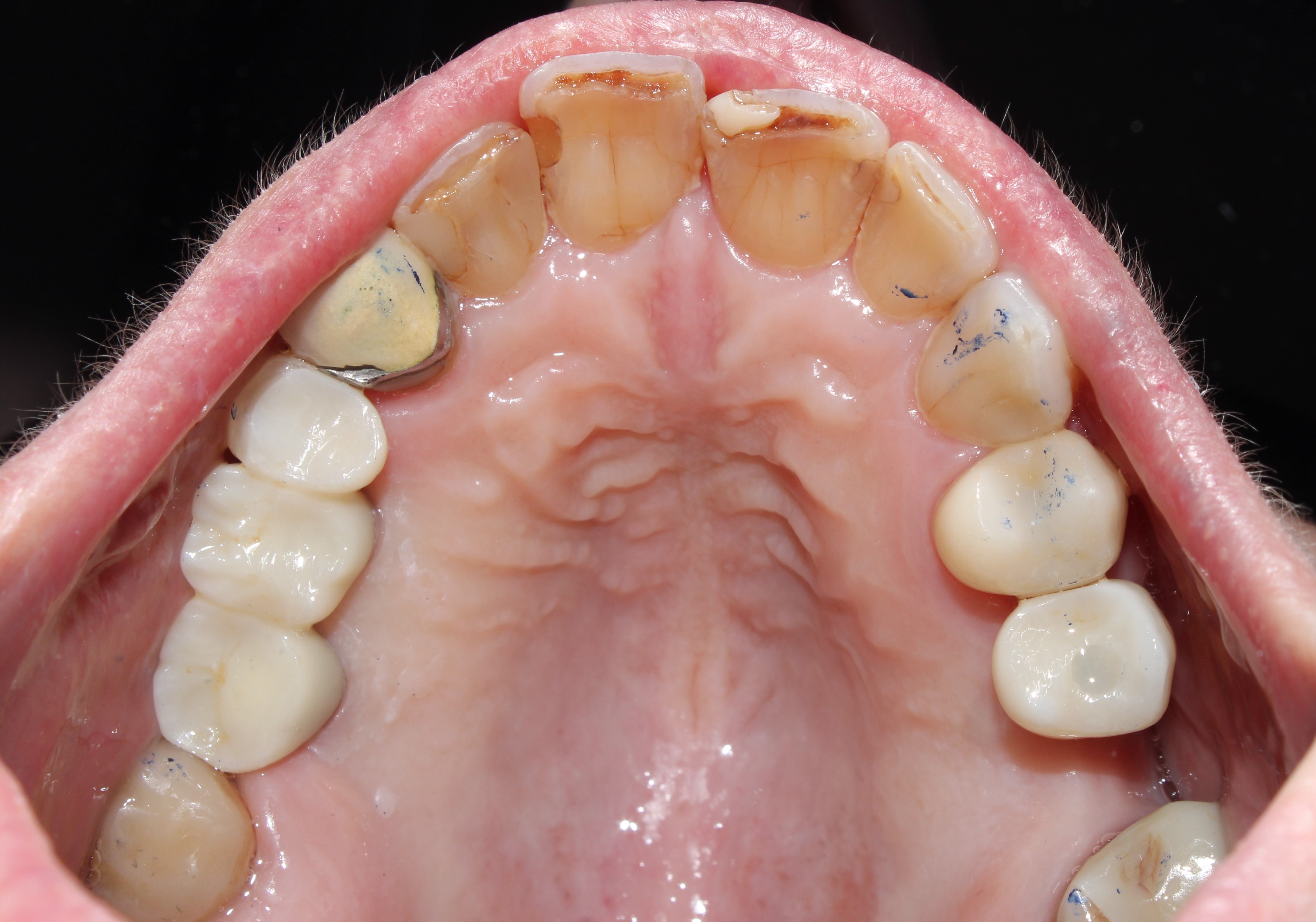 Case 02 after treatment