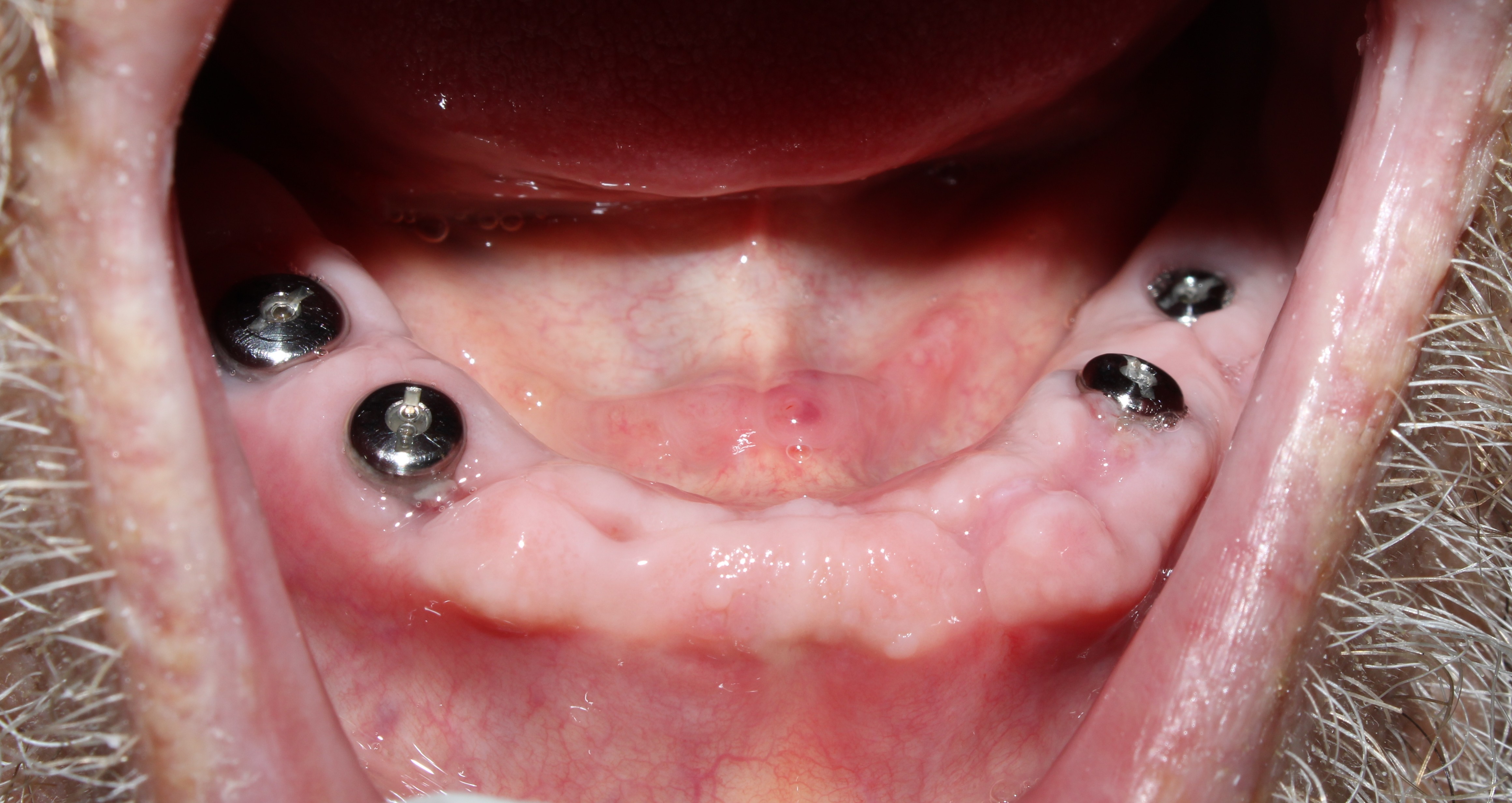 Case 04 after treatment