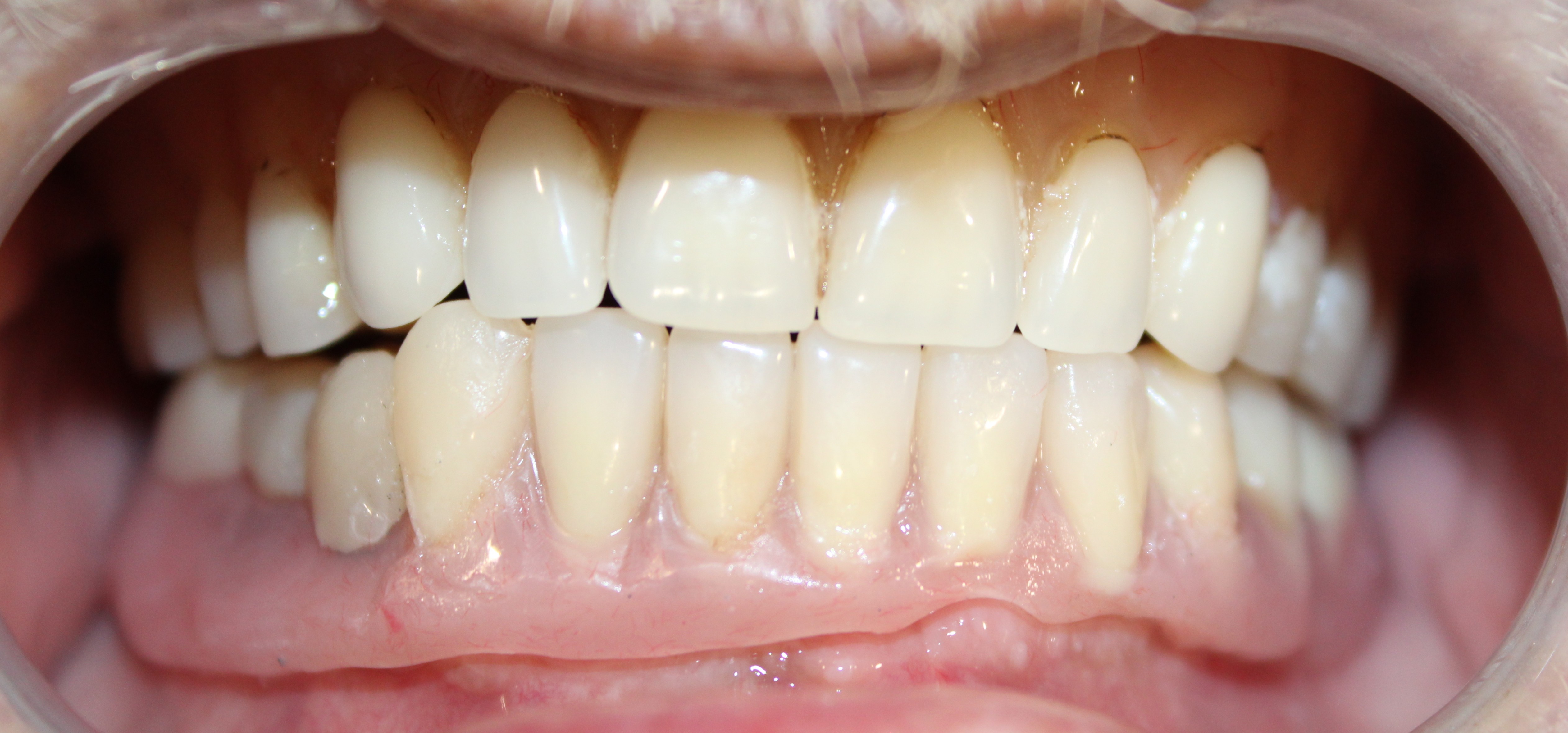 Case 04 additional view
