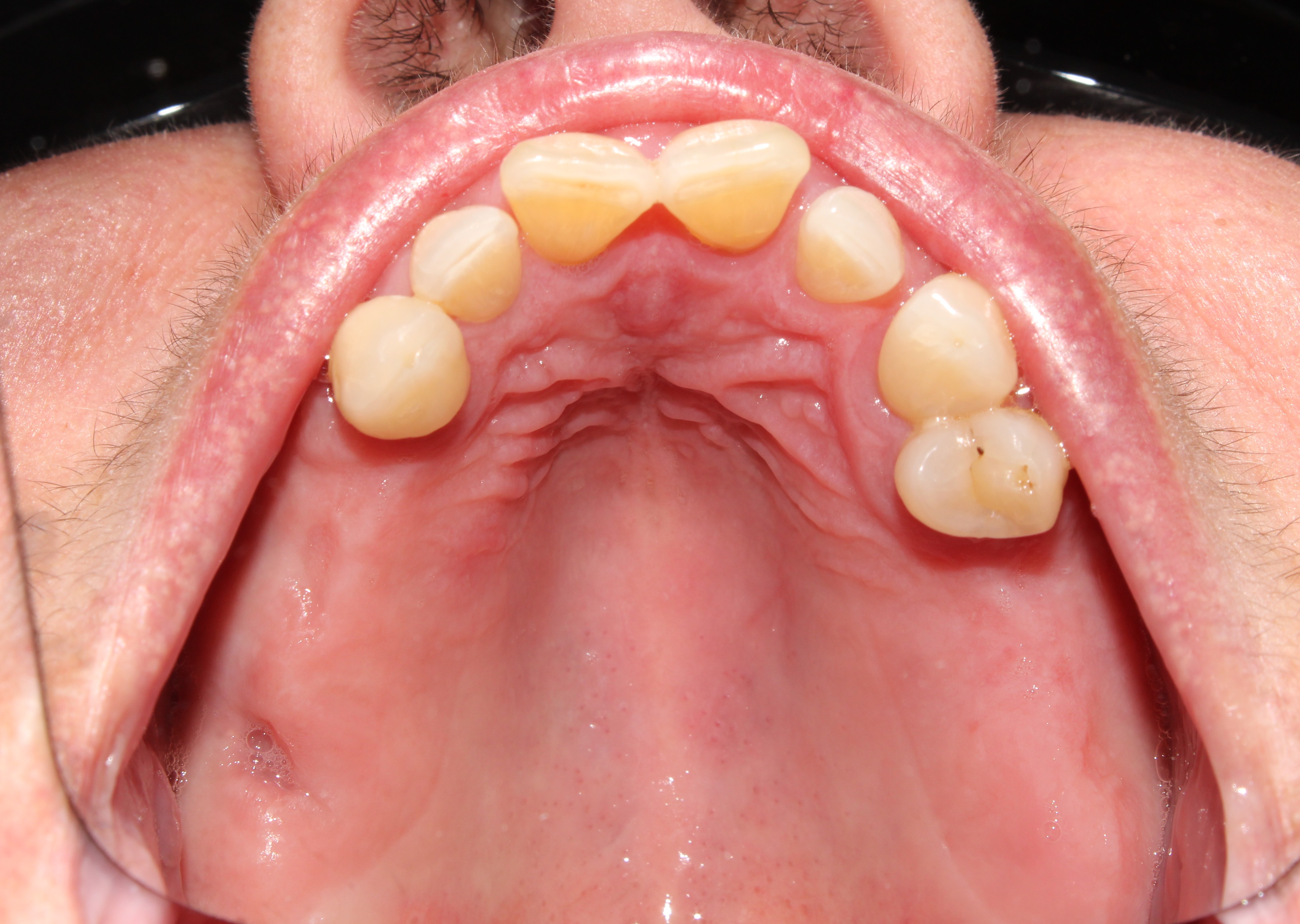 Case 02 before treatment