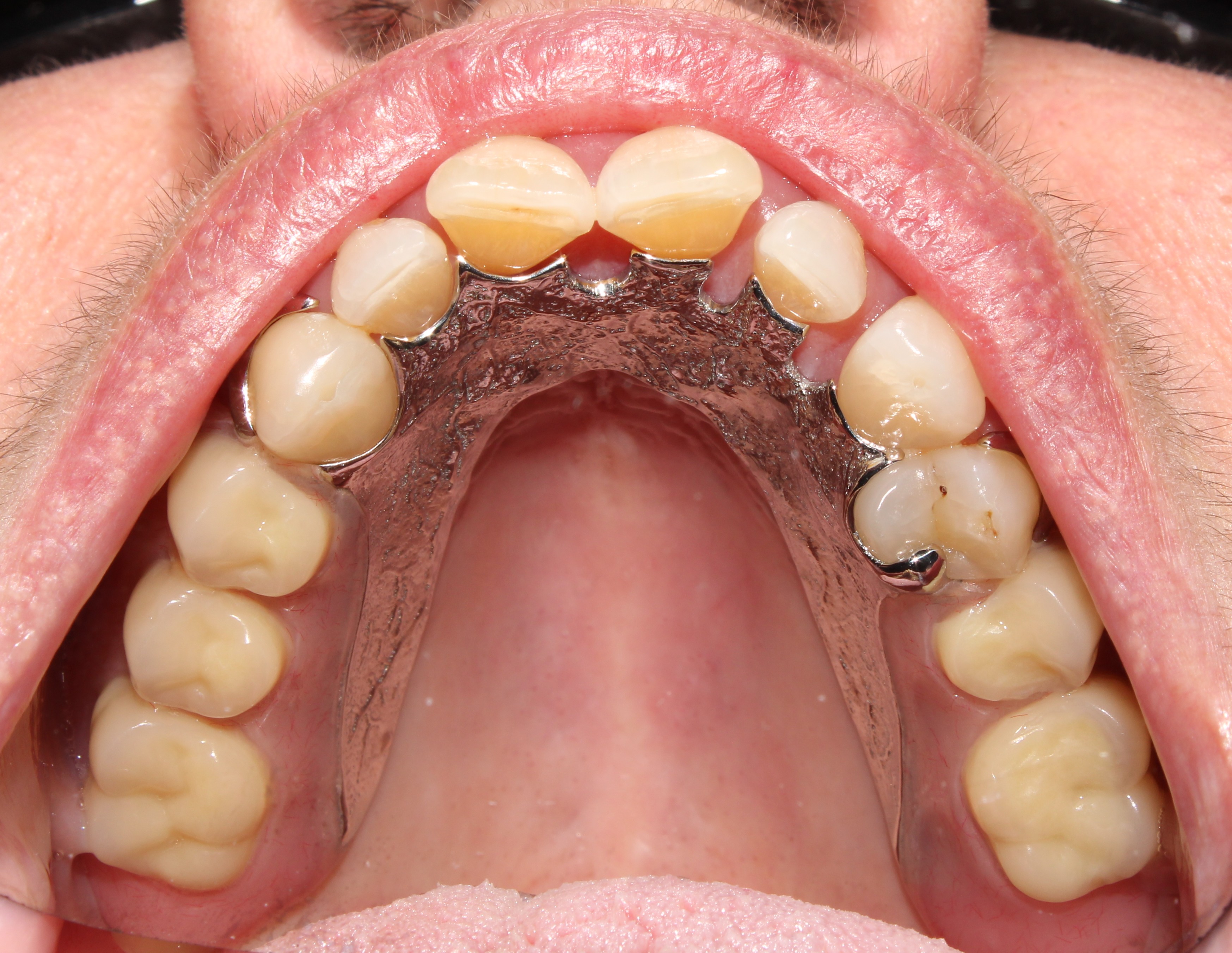 Case 02 after treatment