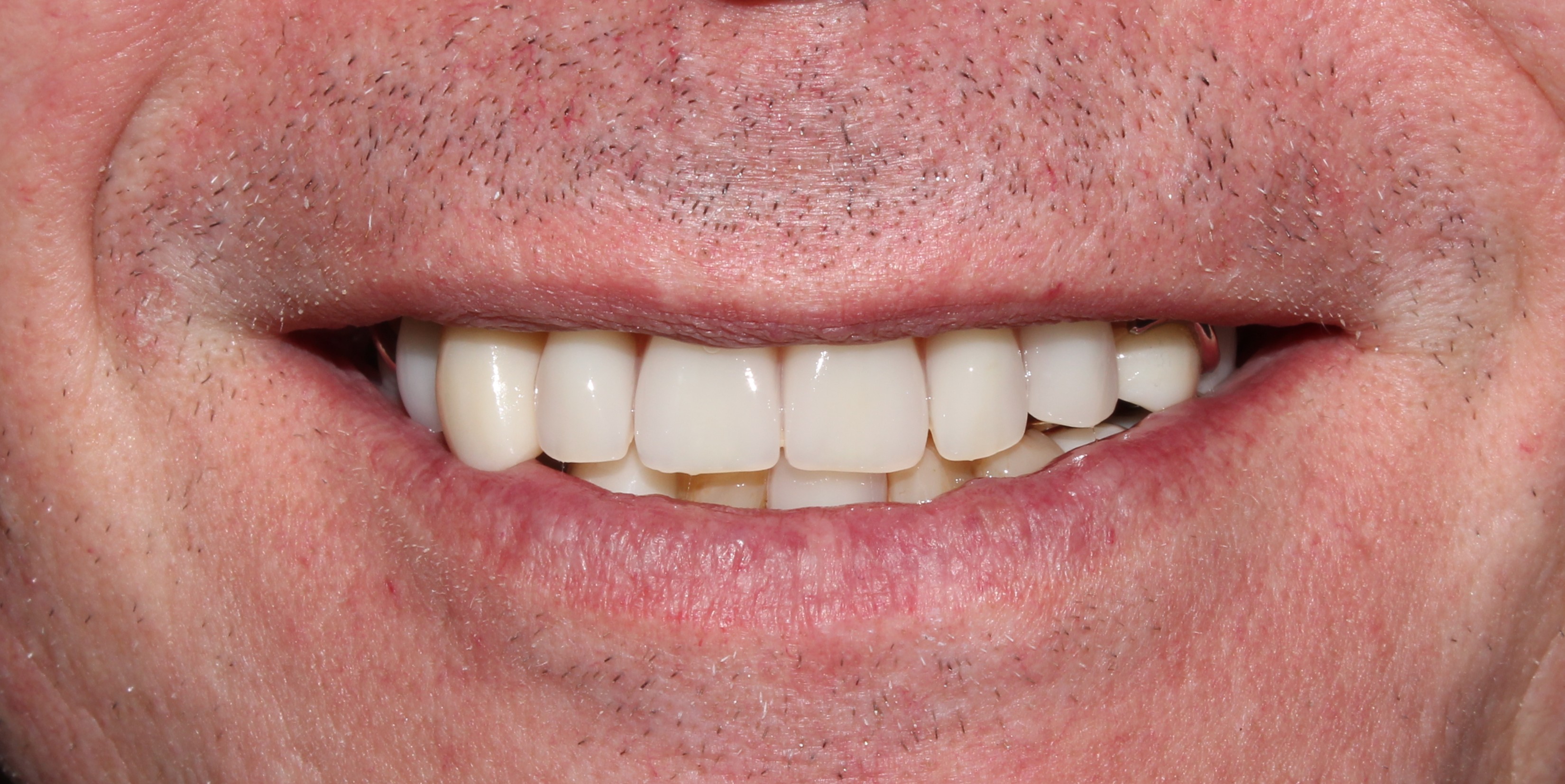 Case 01 after treatment