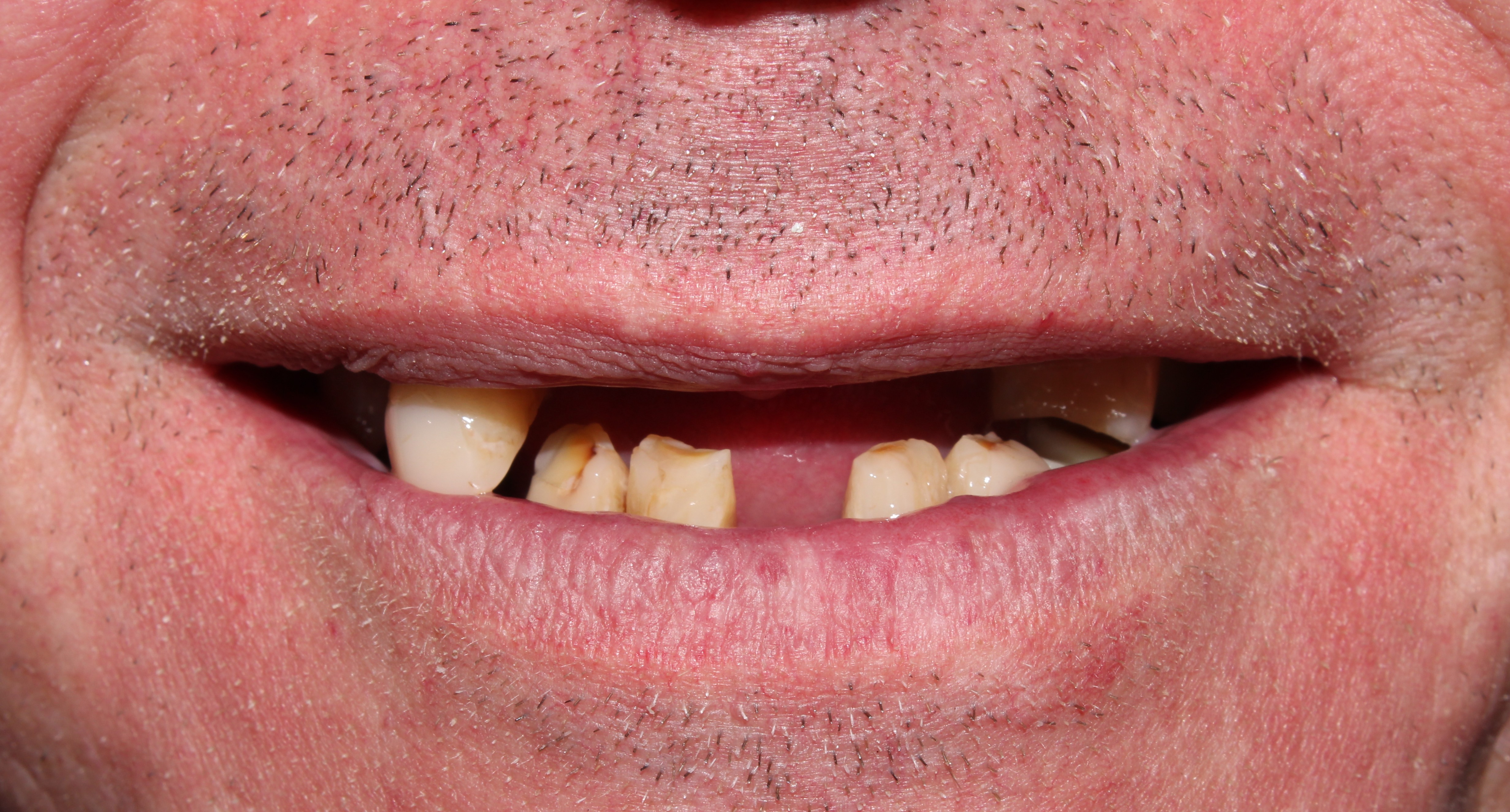 Case 01 before treatment