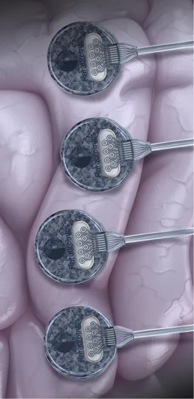 4 coritcal modules on brain surface