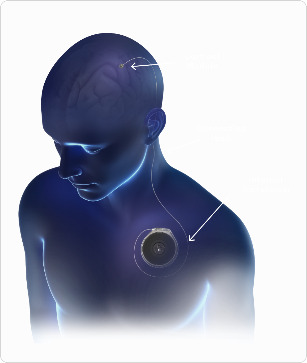 Image of device located over the heart