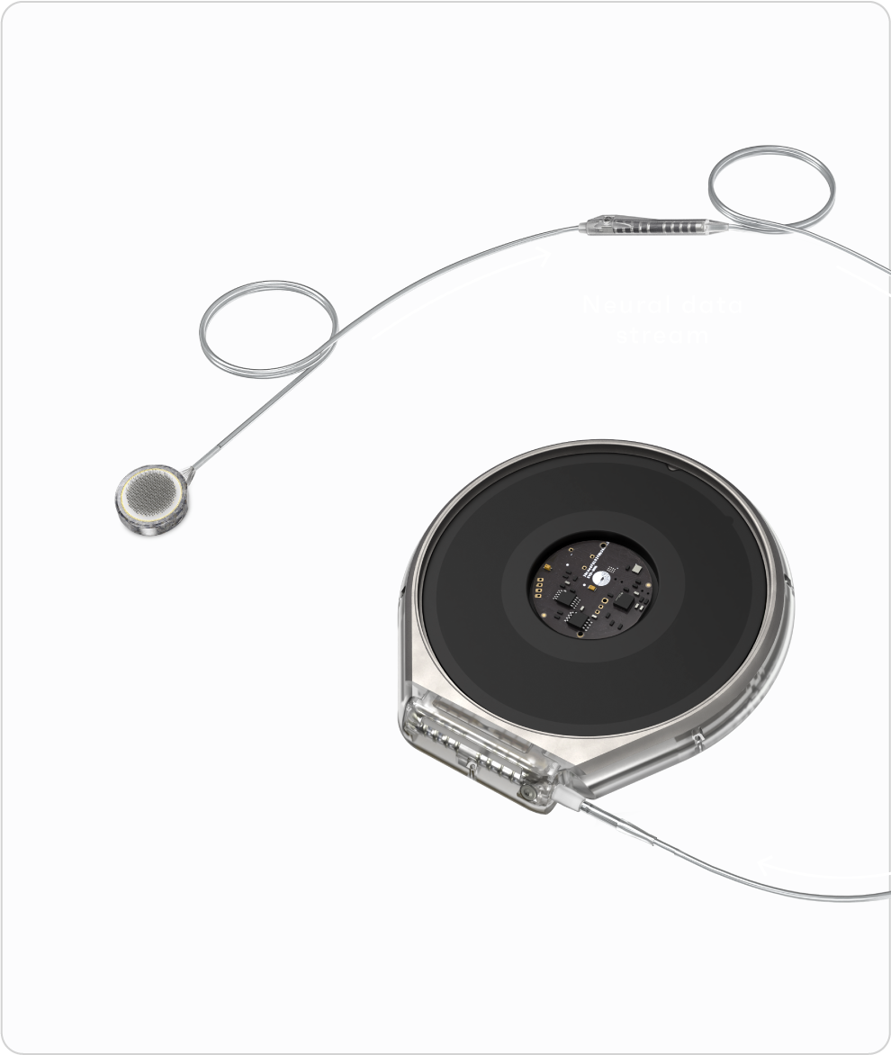 Cortical module with lead line