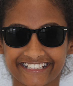 Smile 035