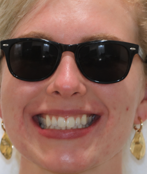 Smile 037