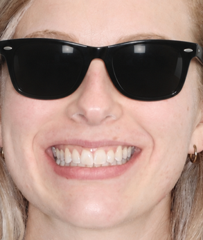 Smile 037