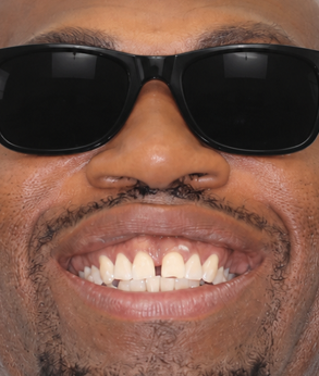 Smile 039