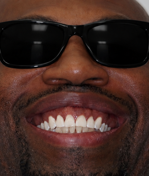 Smile 039
