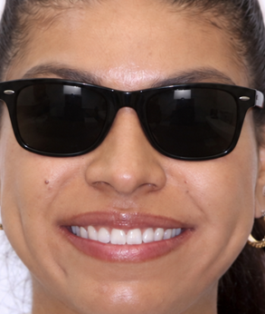 Smile 040
