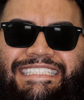 Smile 041