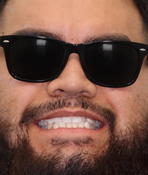 Smile 041