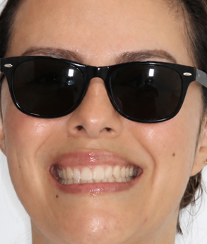 Smile 042