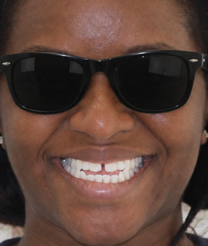 Smile 043