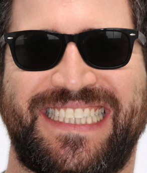 Smile 044