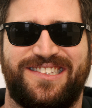 Smile 044